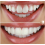 Brighter Image Lab, Adding a New Life to Your Smile