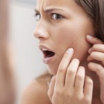 cure-cystic-acne-at-home