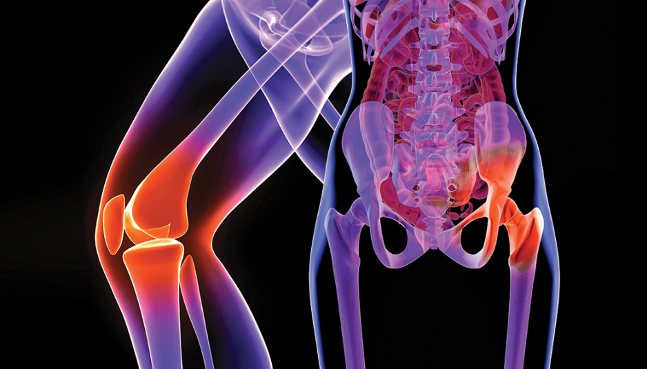 Hip and Knee Replacement Facts