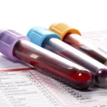Blood-Tests