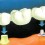 How to Choose a Dental Implant Expert ?
