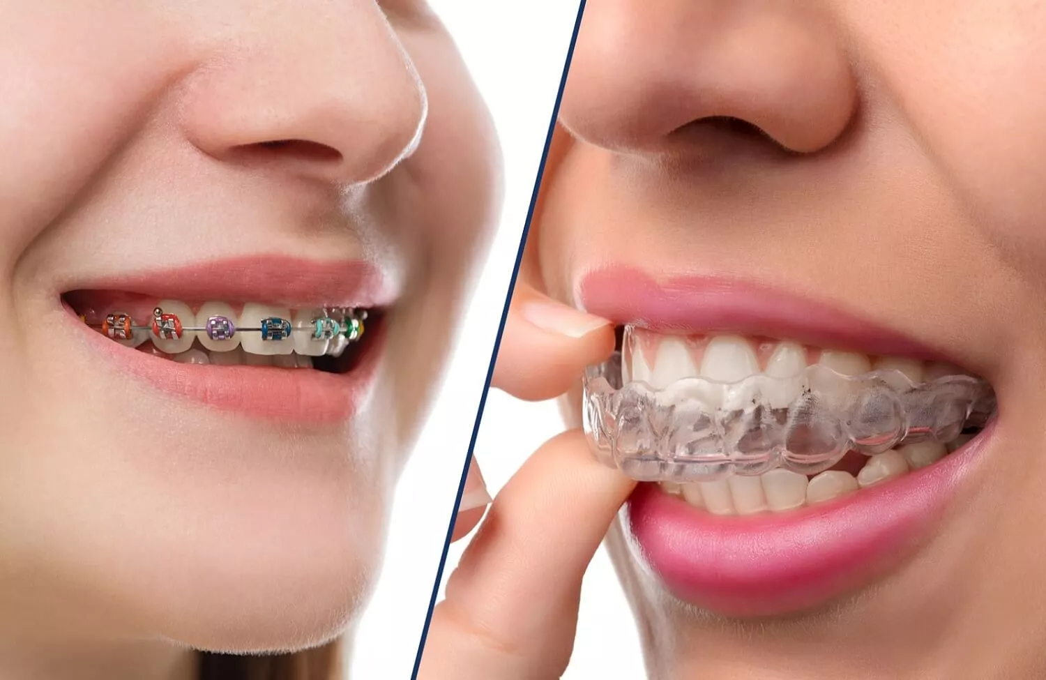 Who Should I See For Orthodontic Treatment?