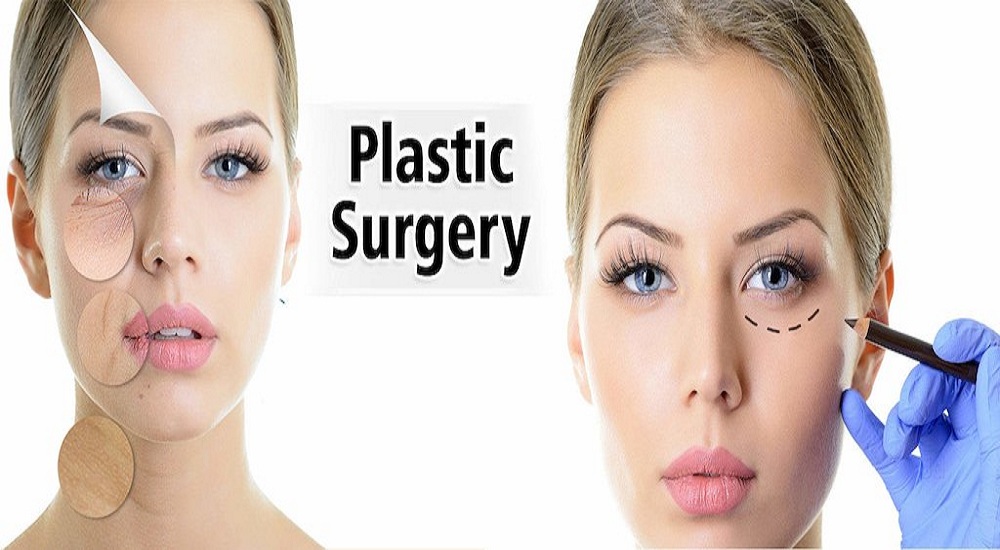 Plastic Surgery: Seven Questions Before You Do