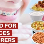 What Food to Eat or Avoid in the First Week with Braces