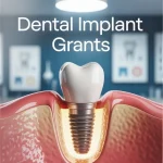 Dental Implant Grants